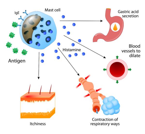 Nutritional Solutions for Hay Fever- Histamine