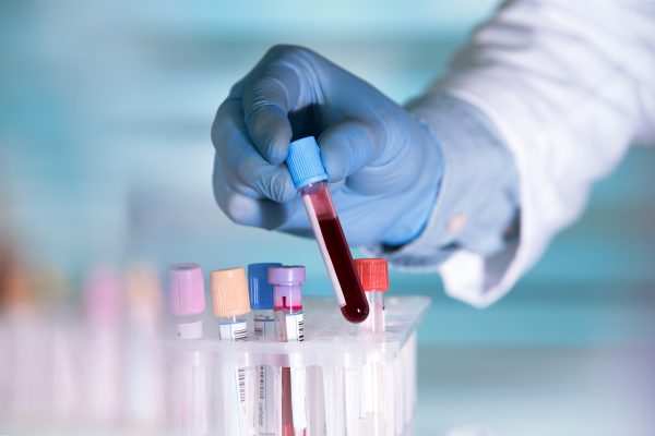 Blood testing